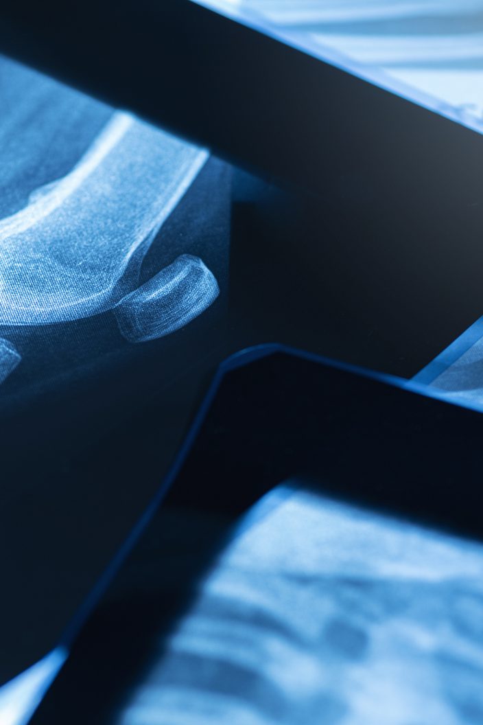 Closeup of different x-ray images on the table